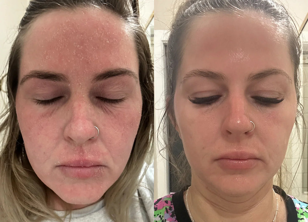 <p><strong>Half a Million Women. One Clear Choice.</strong></p>