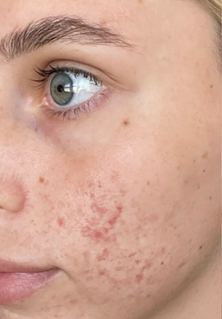 <p><strong>Half a Million Women. One Clear Choice.</strong></p>