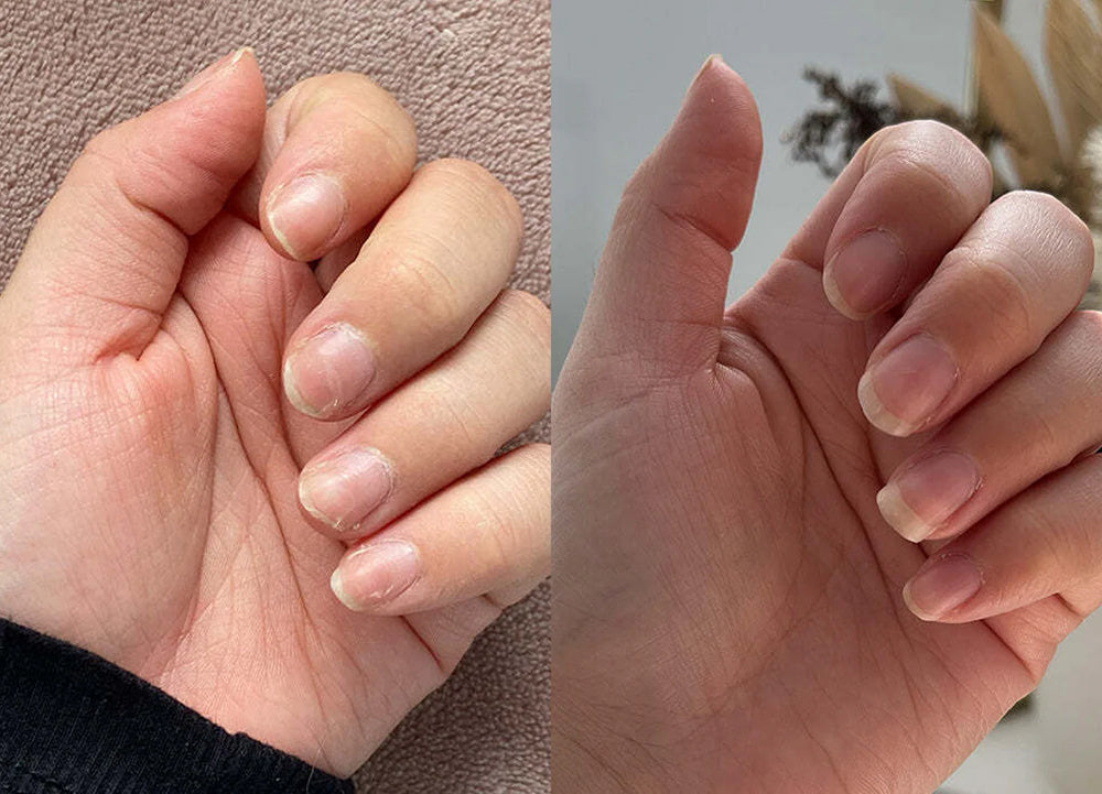 <p><strong>Half a Million Women. One Clear Choice.</strong></p>