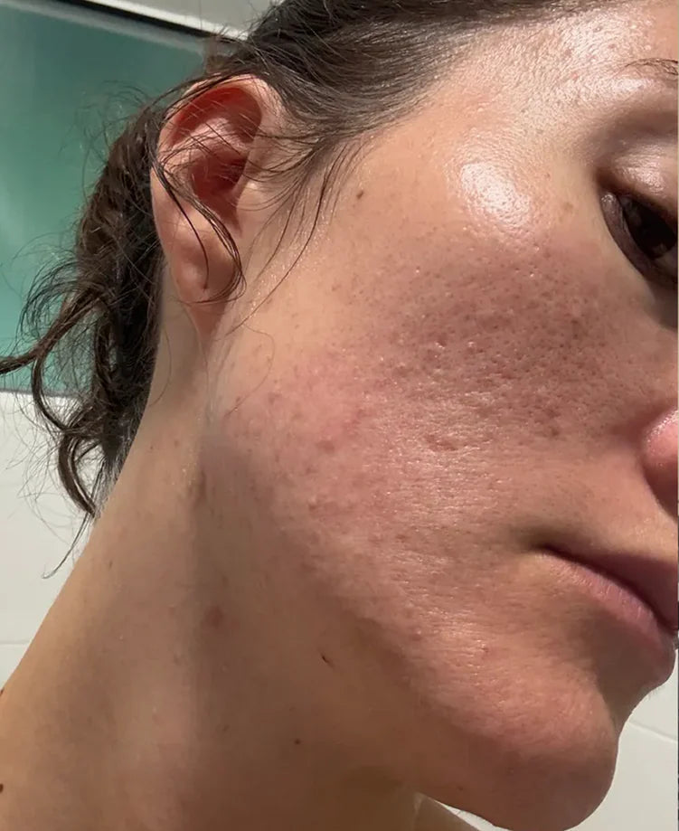 <p><strong>Half a Million Women. One Clear Choice.</strong></p>